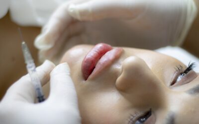 La rhinoplastie par injection : améliorez l’esthétique de votre nez avec l’acide hyaluronique